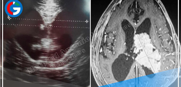 España: Un estudio genético revela la relación entre la salud del cerebro e intestino 