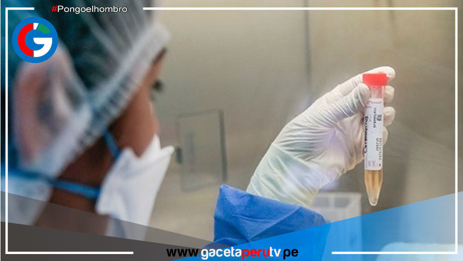 Viruela símica: Próximamente llegará al Perú el primer lote de la vacuna
