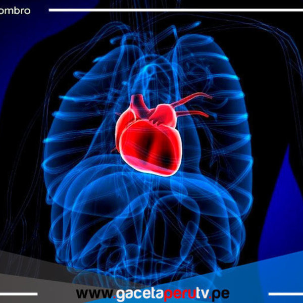 ¿Qué es el síndrome del corazón roto?