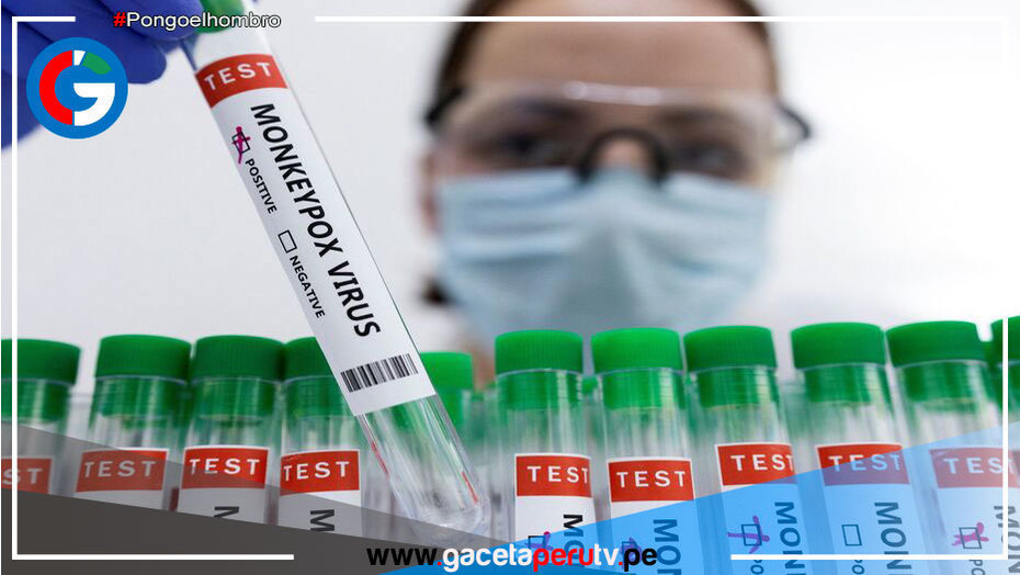 Primer lote de vacunas contra la viruela del mono llegará al Perú el 19 de octubre