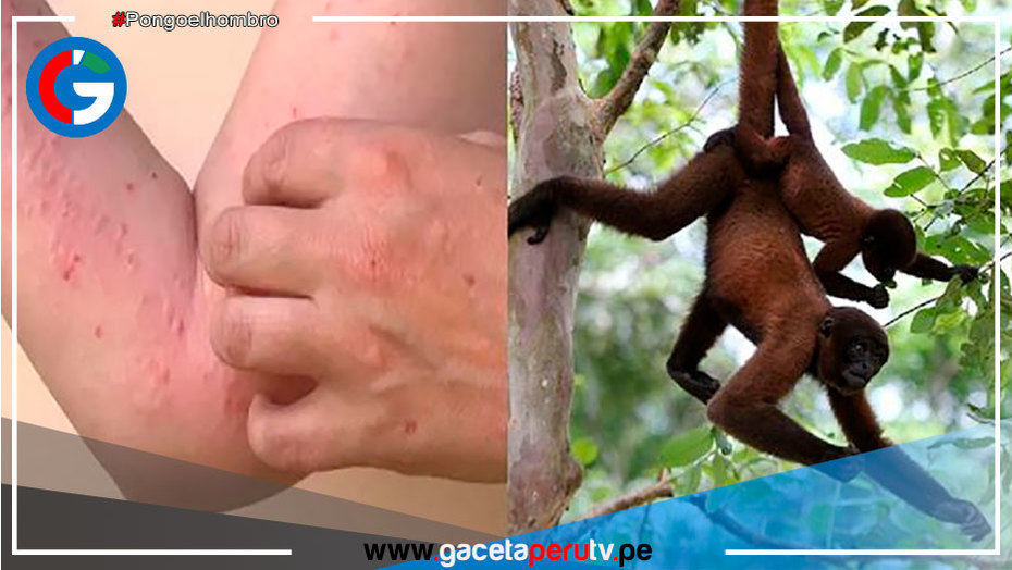 La OMS rebautiza la viruela del mono para evitar estigmatización a primates