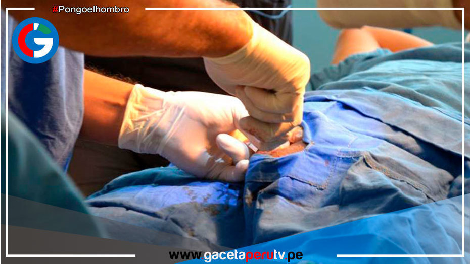 Del 14 al 18 de noviembre se promoverá la vasectomía a nivel nacional