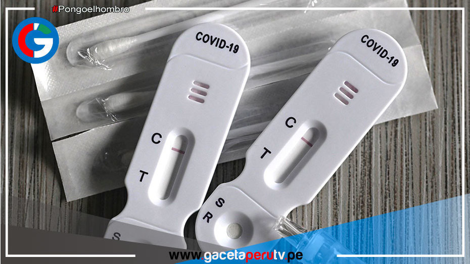 Recomiendan no comprar autotest covid-19 vía páginas web o redes sociales