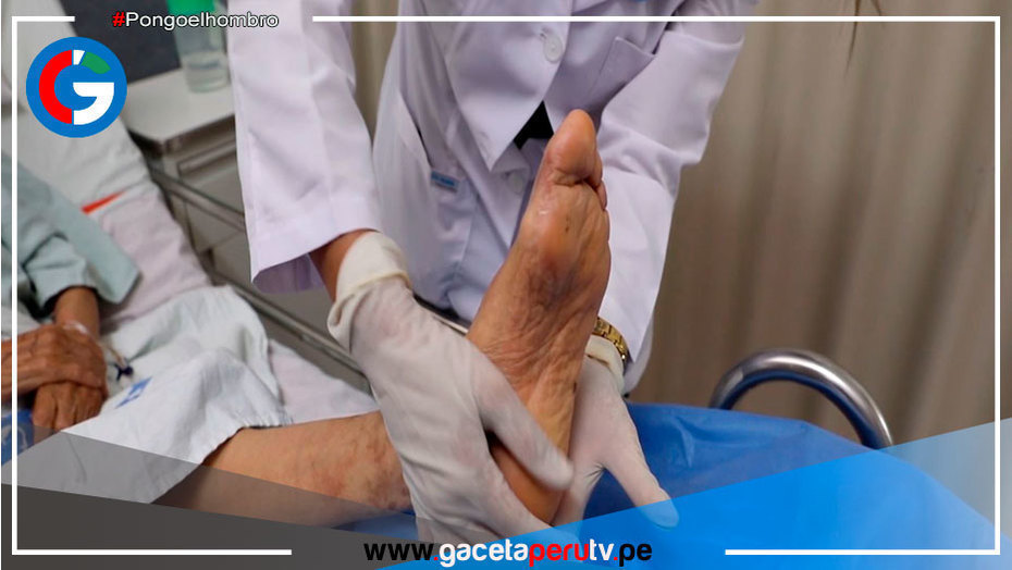 ¿Cómo prevenir y disminuir el riesgo de una amputación?