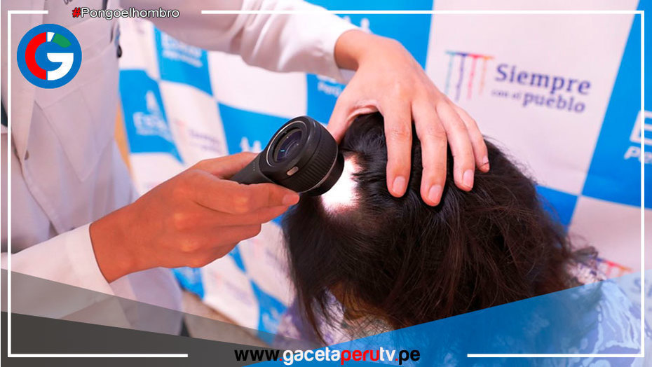 60% de mujeres reportan caída del cabello tras sufrir covid-19