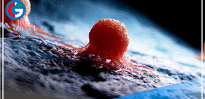 Hallan anticuerpo que previene la metástasis en enfermos de cáncer 