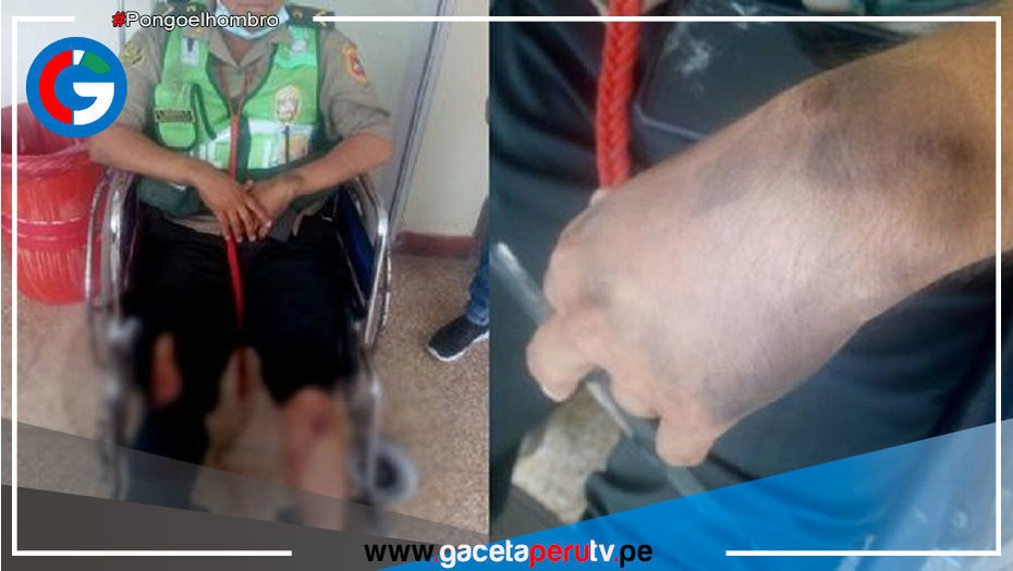 Un policía de tránsito resultó gravemente herido tras ser arrastrado por un automóvil