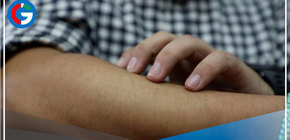 Emiten alerta epidemiológica ante el riesgo de ingreso de viruela del mono al Perú 