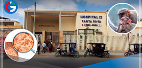 Investigan posible caso de viruela del mono en hombre de 70 años en Piura