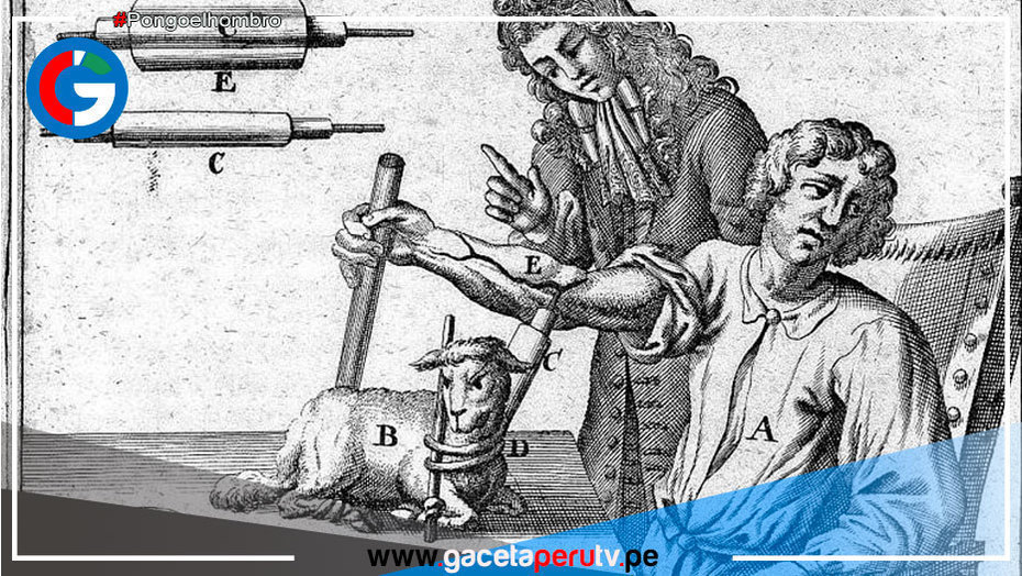 El 15 de junio de 1667 (hace 355 años), Jean-Baptiste Denys realizó la primera transfusión de sangre