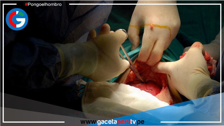 México: Médicos le cortan oreja a un recién nacido tras practicar una cesárea en pleno apagón