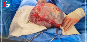 Villa El Salvador: especialistas extirpan tumor de 7 kilos a madre de familia 