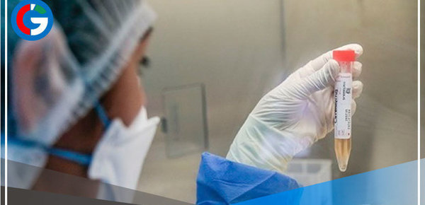 Áncash: en 300% aumenta demanda en laboratorio para descartar covid-19 