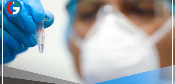 Viruela del mono: 305 los casos confirmados en Perú