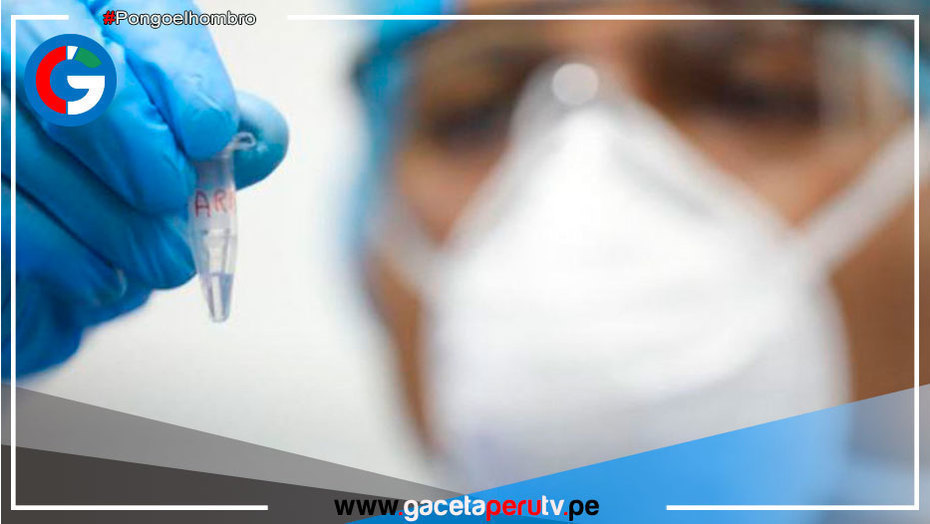 Viruela del mono: 305 los casos confirmados en Perú
