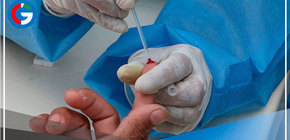 Viruela del mono: 340 casos en Perú