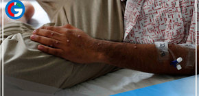 Viruela símica:  1,808 casos en Perú