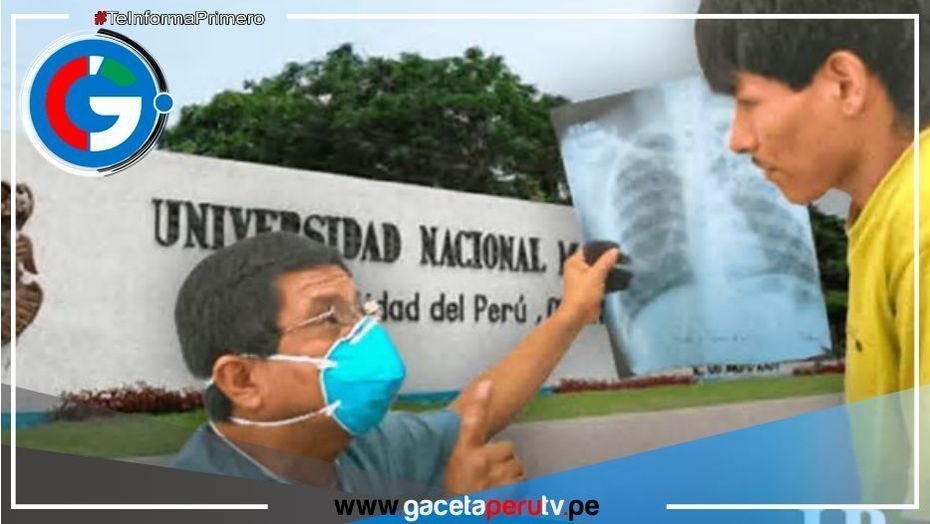 Alarmante brote de TBC en Facultad de Ingeniería Industrial de San Marcos despierta preocupación entre estudiantes
