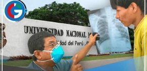 Alarmante brote de TBC en Facultad de Ingeniería Industrial de San Marcos despierta preocupación entre estudiantes