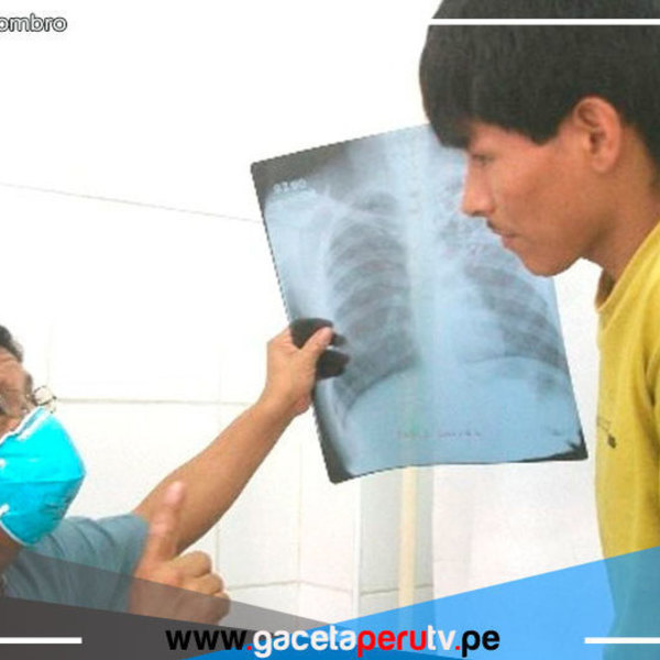 Si tienes tos por más de 15 días debes realizarte un examen de descarte