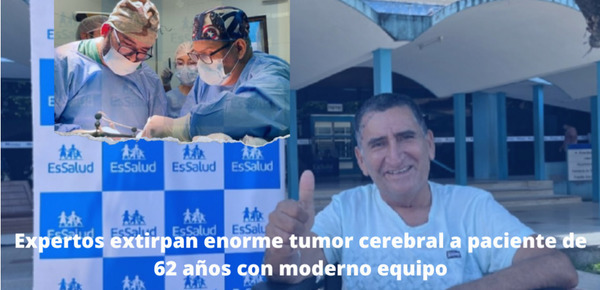 Expertos extirpan enorme tumor cerebral a paciente de 62 años con moderno equipo