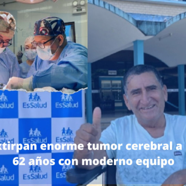 Expertos extirpan enorme tumor cerebral a paciente de 62 años con moderno equipo