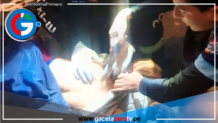 Paramédicos de Comas Rescatan a Adulto Mayor Atropellada en la Av. Túpac Amaru