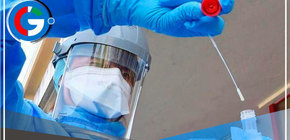 Detectados en Perú dos casos de la variante EG.5 de la COVID-19