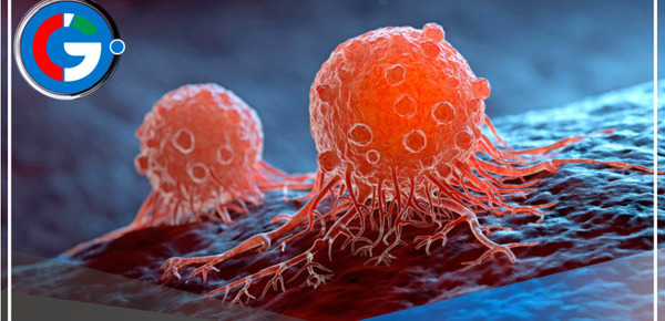 5 síntomas del cáncer que pasan desapercibidos en la sociedad