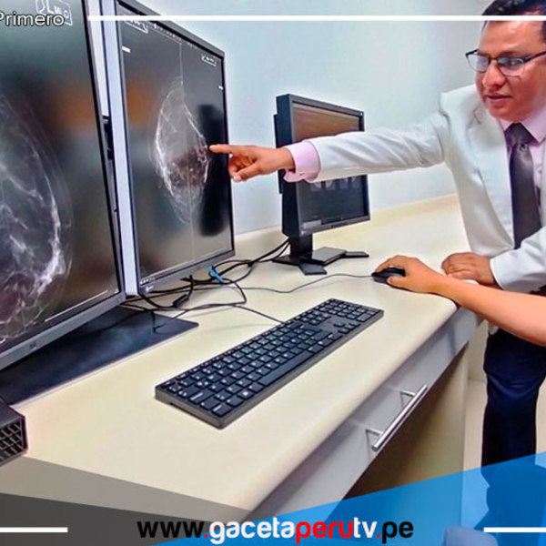 Inauguran moderna sala de mamografía en el Hospital de Ventanilla 
