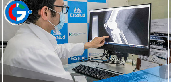 Realizan más de 80,000 atenciones a pacientes con osteoporosis a nivel nacional 
