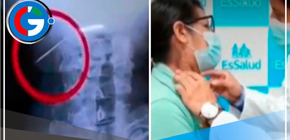 La Victoria: Mujer se traga un clavo mientras comía pan con chicharrón