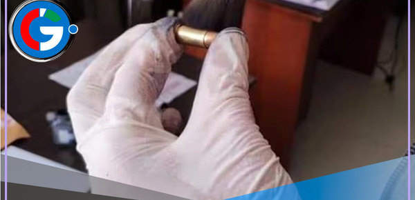 VMT: delincuentes balean a docente por resistirse al robo de su cartera