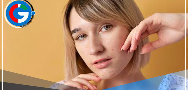 Cambios de estación afectan la salud de la piel