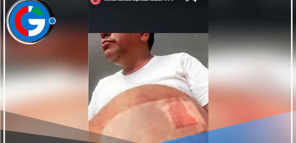 Rennan Espinoza sale ileso de accidente y desata controversia por su actuación posterior