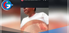 Rennan Espinoza sale ileso de accidente y desata controversia por su actuación posterior