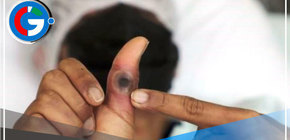 Viruela símica: Actualizarán plan de respuesta en prevención a nuevo linaje 