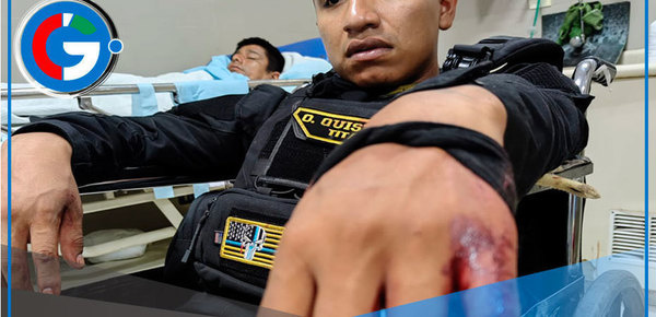 Tres serenos atacados gravemente en operativo municipal de Comas