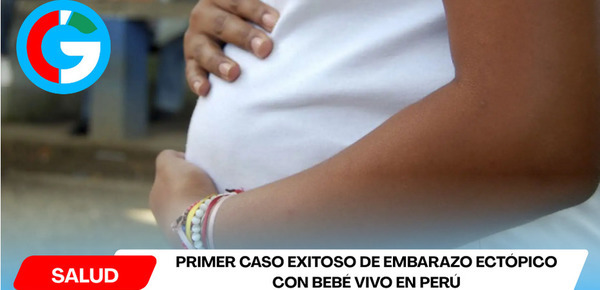 Primer caso exitoso de embarazo ectópico con bebé vivo en Perú