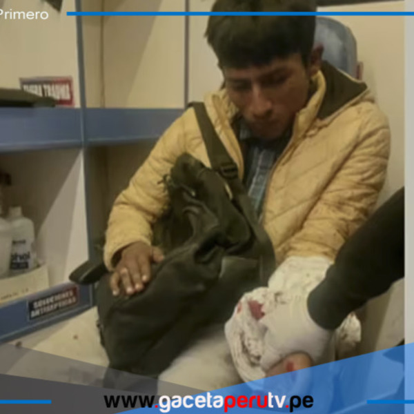 Conmoción en Ate:  joven se queda dormido en rieles y es arrollado por tren, pero resulta ileso