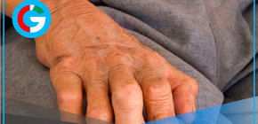 Lepra es curable con tratamiento gratuito, alerta OMS y Minsa