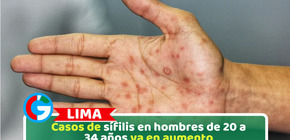 Casos de sífilis en hombres de 20 a 34 años va en aumento